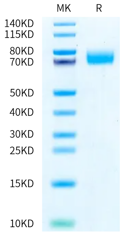Human B7-H3 (4Ig) on Bis-Tris PAGE under reduced condition. The purity is greater than 95%.Recombinant Human B7-H3 (4Ig) /B7-H3b Protein, Active