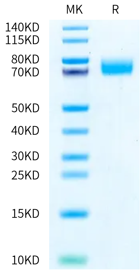 Human B7-H3 (4Ig) on Bis-Tris PAGE under reduced condition. The purity is greater than 95%.Recombinant Human B7-H3 (4Ig) /B7-H3b Protein, Active