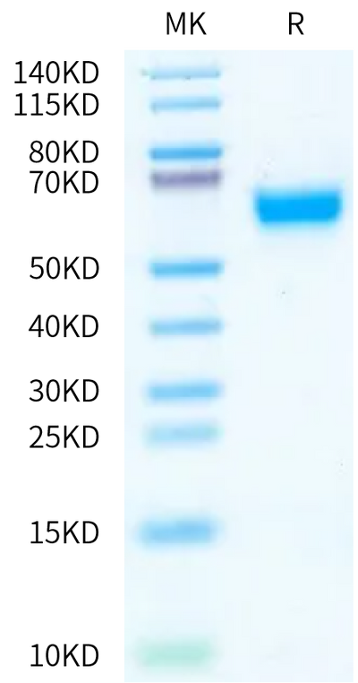 Biotinylated Human IL-18RAP on Bis-Tris PAGE under reduced condition. The purity is greater than 95%.Biotinylated Human IL-18RAP/IL-18 R beta Protein, Active