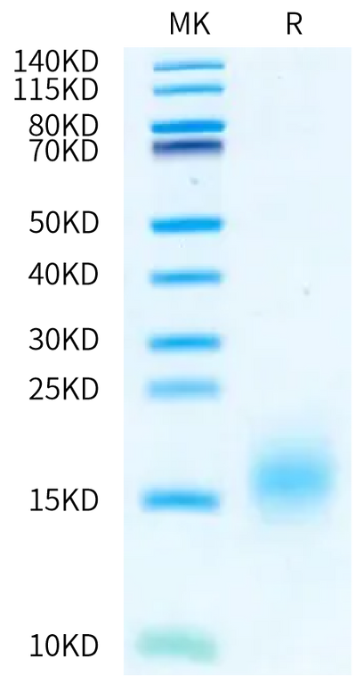 Human BCMA (S30del) on Bis-Tris PAGE under reduced condition. The purity is greater than 95%.Recombinant Human BCMA/TNFRSF17 (S30del) Protein, Active