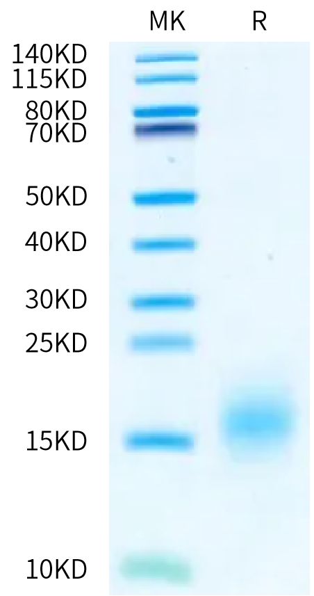 Human BCMA (S30del) on Bis-Tris PAGE under reduced condition. The purity is greater than 95%.Recombinant Human BCMA/TNFRSF17 (S30del) Protein, Active