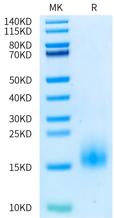 Human BCMA (R27P) on Bis-Tris PAGE under reduced condition. The purity is greater than 95%.Recombinant Human BCMA/TNFRSF17 (R27P) Protein, Active