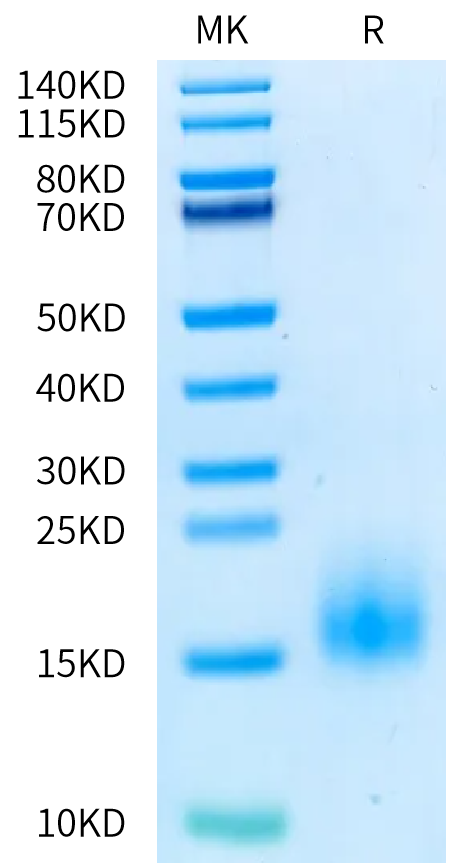 Human BCMA (R27P) on Bis-Tris PAGE under reduced condition. The purity is greater than 95%.Recombinant Human BCMA/TNFRSF17 (R27P) Protein, Active