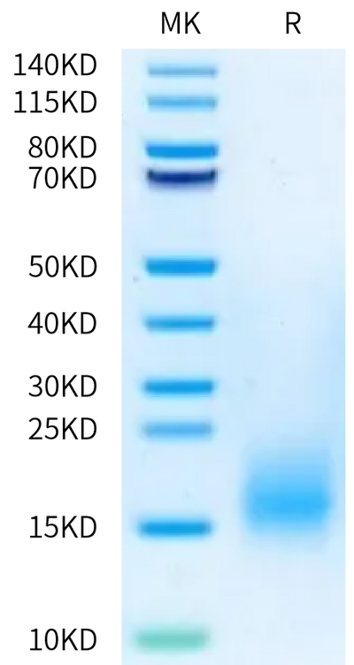 Human BCMA (P34del) on Bis-Tris PAGE under reduced condition. The purity is greater than 95%.Recombinant Human BCMA/TNFRSF17 (P34del) Protein, Active