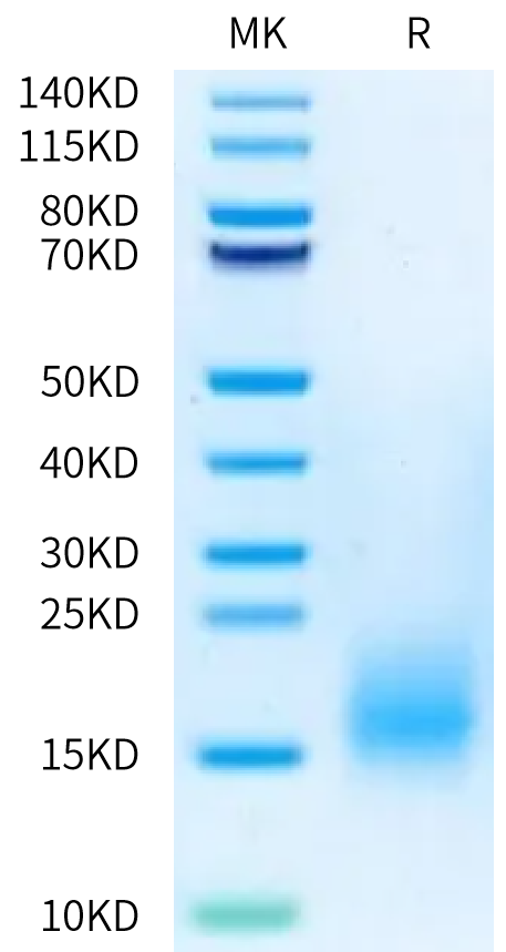 Human BCMA (P34del) on Bis-Tris PAGE under reduced condition. The purity is greater than 95%.Recombinant Human BCMA/TNFRSF17 (P34del) Protein, Active