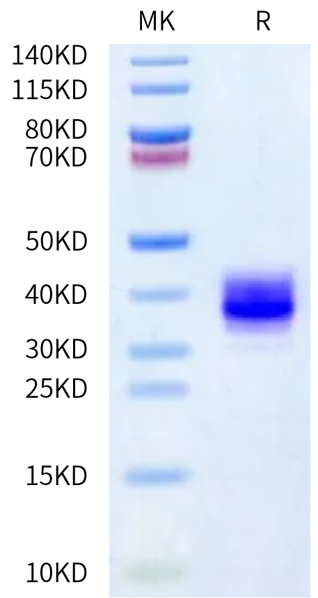 Human Coagulation factor XI (C500S) on Bis-Tris PAGE under reduced condition. The purity is greater than 95%.Recombinant Human Coagulation factor XI (C500S) Protein, Active