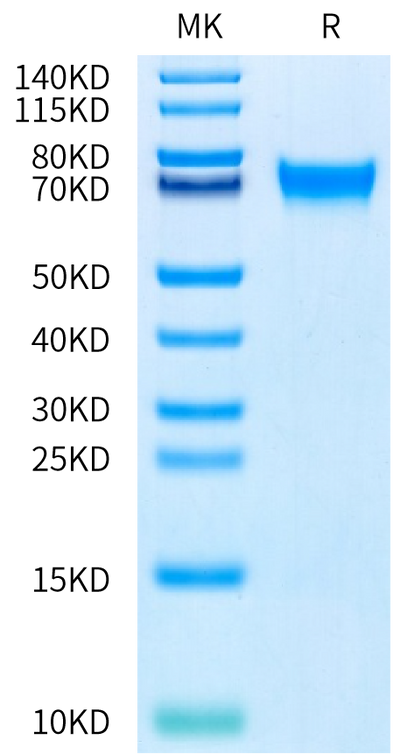 Human PD-1 on Bis-Tris PAGE under reduced condition. The purity is greater than 95%.Recombinant Human PD-1/PDCD1 Protein, Active