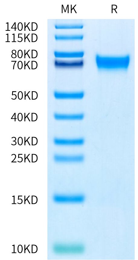 Human PD-1 on Bis-Tris PAGE under reduced condition. The purity is greater than 95%.Recombinant Human PD-1/PDCD1 Protein, Active