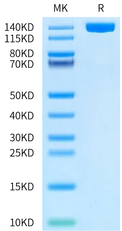 Human CD13 on Bis-Tris PAGE under reduced condition. The purity is greater than 95%.Recombinant Human CD13/ANPEP Protein, Active