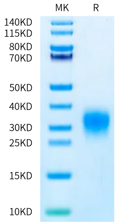Human TSLP (R127A, R130A) on Bis-Tris PAGE under reduced condition. The purity is greater than 95%.Recombinant Human TSLP (R127A, R130A) Protein, Active
