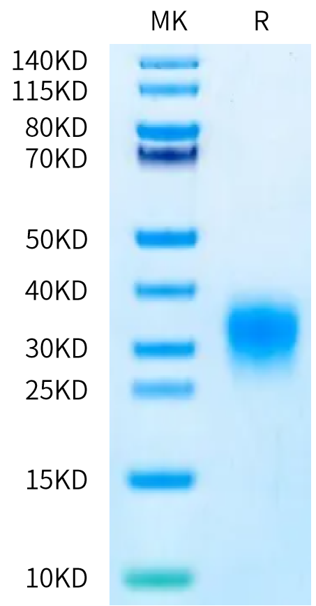 Human TSLP (R127A, R130A) on Bis-Tris PAGE under reduced condition. The purity is greater than 95%.Recombinant Human TSLP (R127A, R130A) Protein, Active