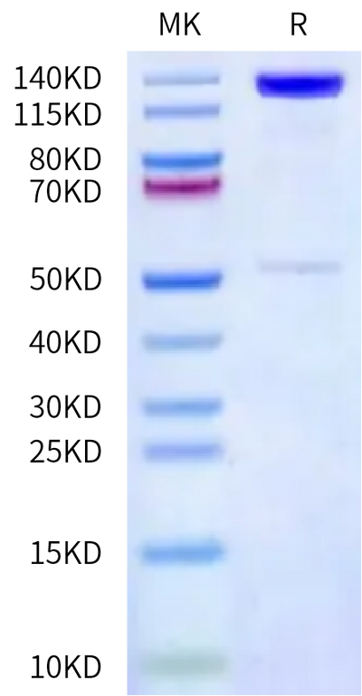 Human CDH17 on Bis-Tris PAGE under reduced condition. The purity is greater than 90%.Recombinant Human CDH17/Cadherin 17 Protein, Active