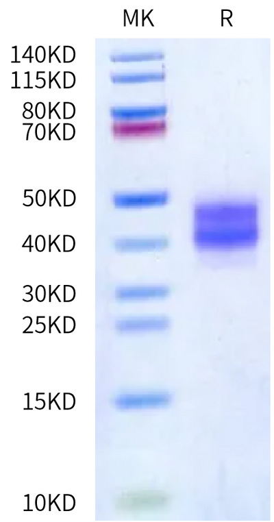 Biotinylated Mouse FOLR1 on Bis-Tris PAGE under reduced condition. The purity is greater than 95%.Biotinylated Mouse FOLR1 Protein
