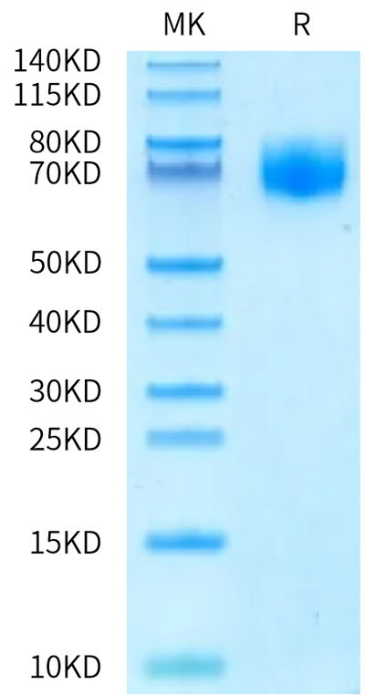 Human FGFR1 alpha (IIIc) on Bis-Tris PAGE under reduced condition. The purity is greater than 95%.Recombinant Human FGFR1 alpha (IIIc) Protein, Active