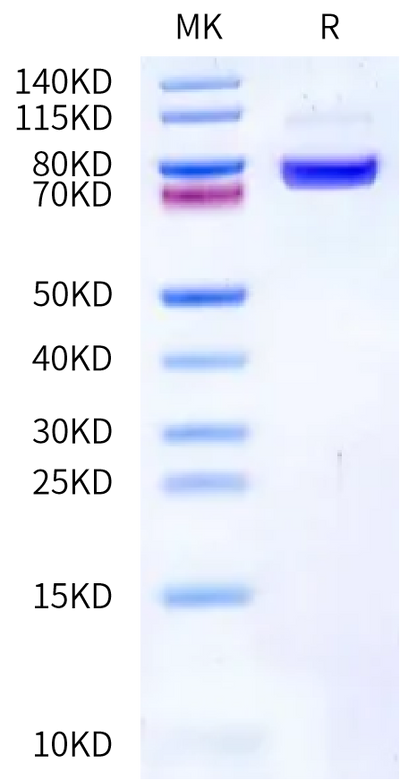 Biotinylated Human Endoglin on Bis-Tris PAGE under reduced condition. The purity is greater than 95%.Biotinylated Human Endoglin/CD105 Protein, Active