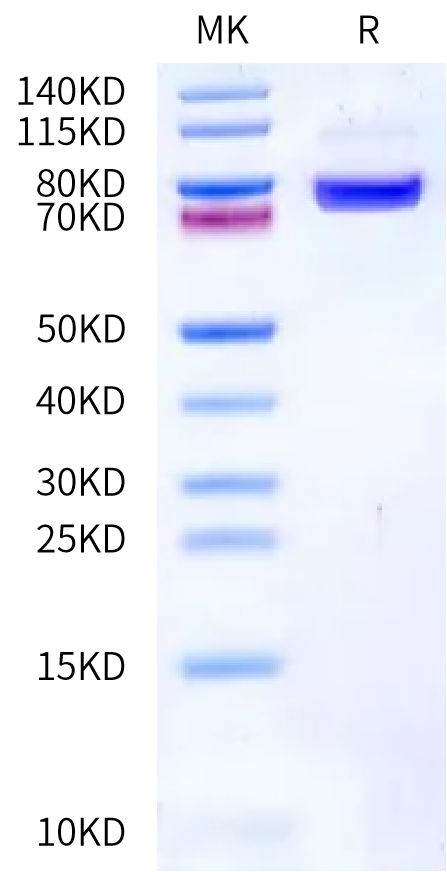 Biotinylated Human Endoglin on Bis-Tris PAGE under reduced condition. The purity is greater than 95%.Biotinylated Human Endoglin/CD105 Protein, Active