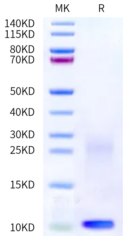 Human TSLP on Bis-Tris PAGE under reduced condition. The purity is greater than 95%.Recombinant Human TSLP Protein, Active