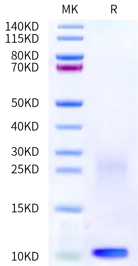 Human TSLP on Bis-Tris PAGE under reduced condition. The purity is greater than 95%.Recombinant Human TSLP Protein, Active