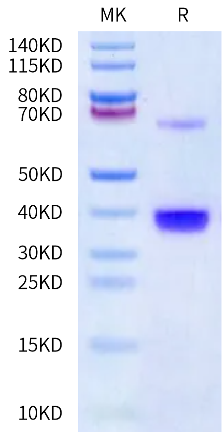 Human IgE on Bis-Tris PAGE under reduced condition. The purity is greater than 90%.Recombinant Human IgE Protein, Active