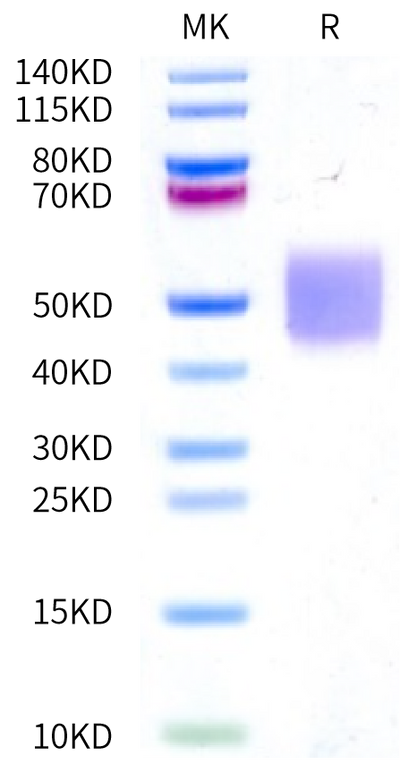 Human Fc gamma RIIIA (V176) on Bis-Tris PAGE under reduced condition. The purity is greater than 95%.Recombinant Human Fc gamma RIIIA/CD16a (V176) Protein, Active