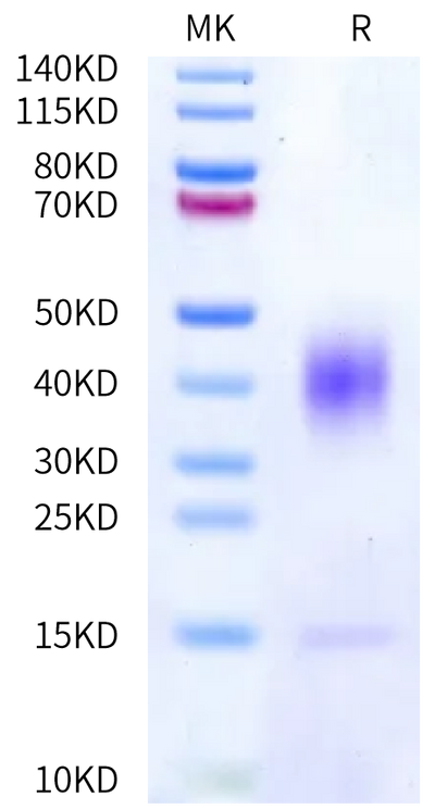 Human IL-13 on Bis-Tris PAGE under reduced condition. The purity is greater than 95%.Recombinant Human IL-13 Protein, Active