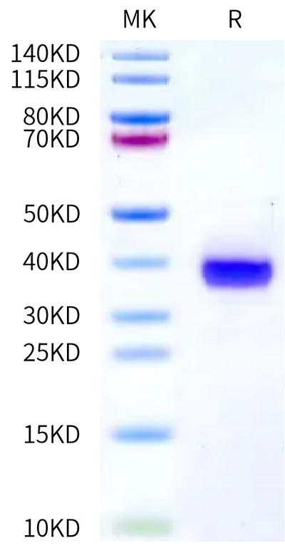 Human Siglec-2 Domain 6&7 on Bis-Tris PAGE under reduced condition. The purity is greater than 95%.Recombinant Human Siglec-2/CD22 Domain 6&7 Protein
