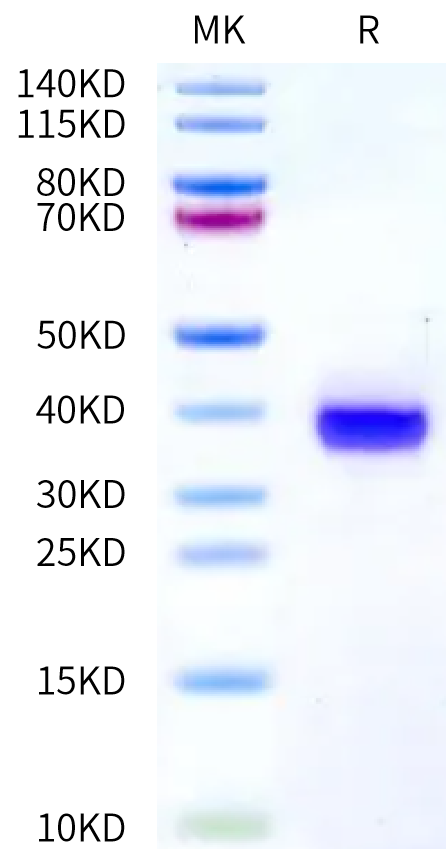 Human Siglec-2 Domain 6&7 on Bis-Tris PAGE under reduced condition. The purity is greater than 95%.Recombinant Human Siglec-2/CD22 Domain 6&7 Protein