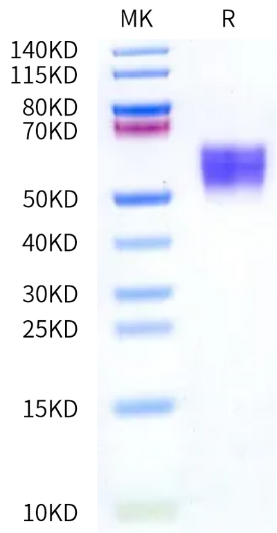 Human B7-H4 on Bis-Tris PAGE under reduced condition. The purity is greater than 95%.Recombinant Human B7-H4 Protein, Active