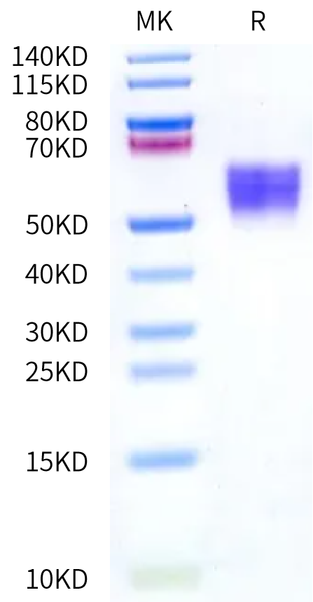 Human B7-H4 on Bis-Tris PAGE under reduced condition. The purity is greater than 95%.Recombinant Human B7-H4 Protein, Active