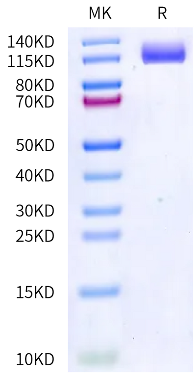 Rabbit VEGF R2 on Bis-Tris PAGE under reduced condition. The purity is greater than 95%.Recombinant Rabbit VEGF R2/KDR Protein, Active