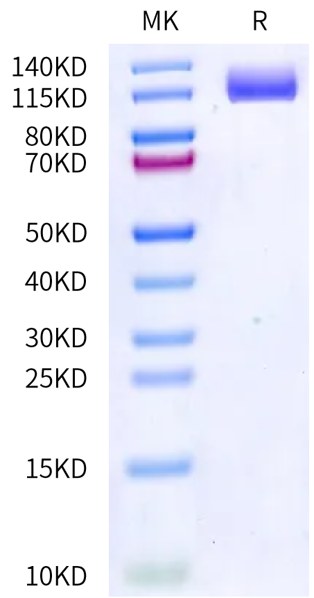 Rabbit VEGF R2 on Bis-Tris PAGE under reduced condition. The purity is greater than 95%.Recombinant Rabbit VEGF R2/KDR Protein, Active