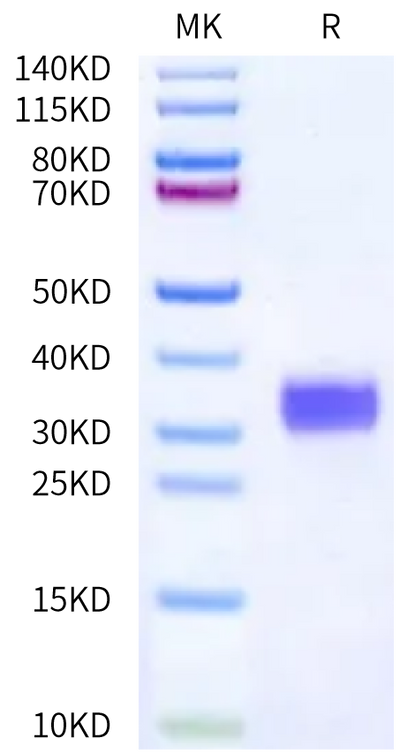 Human Her2 Domain 1 on Bis-Tris PAGE under reduced condition. The purity is greater than 95%.Recombinant Human Her2/ErbB2 Domain 1 Protein