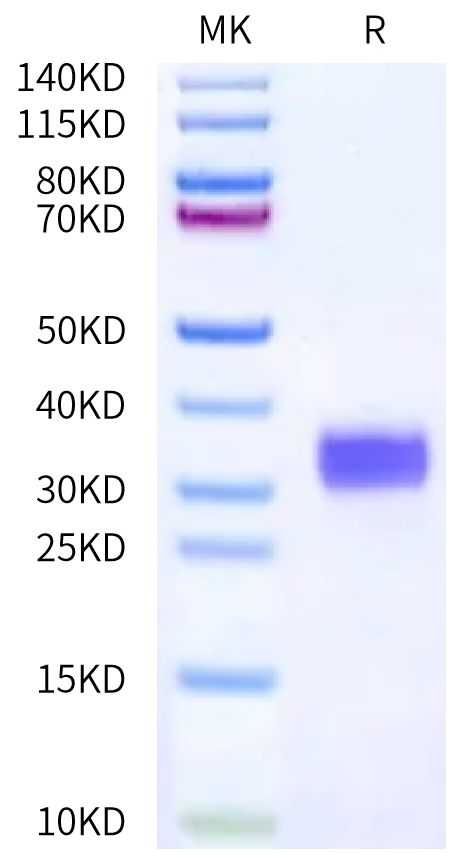 Human Her2 Domain 1 on Bis-Tris PAGE under reduced condition. The purity is greater than 95%.Recombinant Human Her2/ErbB2 Domain 1 Protein