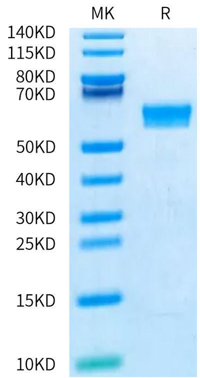 Human CD8 alpha on Bis-Tris PAGE under reduced condition. The purity is greater than 95%.Recombinant Human CD8 alpha/CD8A Protein, Active