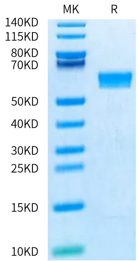 Human CD8 alpha on Bis-Tris PAGE under reduced condition. The purity is greater than 95%.Recombinant Human CD8 alpha/CD8A Protein, Active