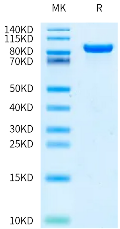 Human DDR1 on Bis-Tris PAGE under reduced condition. The purity is greater than 95%.Recombinant Human DDR1 Protein, Active