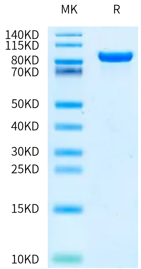 Human DDR1 on Bis-Tris PAGE under reduced condition. The purity is greater than 95%.Recombinant Human DDR1 Protein, Active