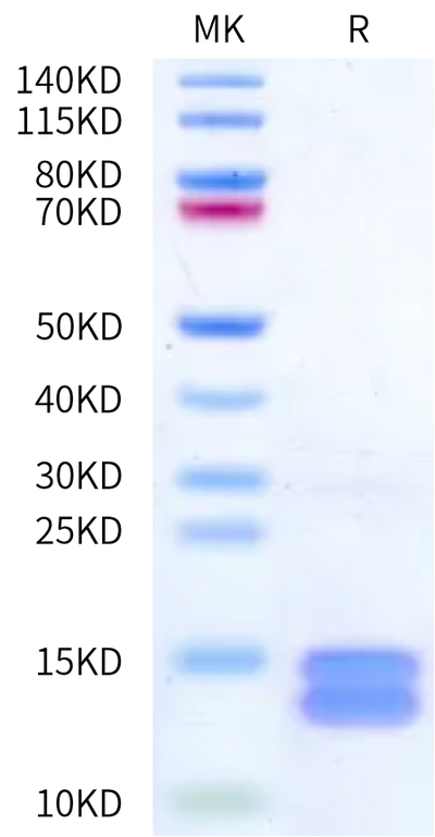 Cynomolgus Calprotectin (S100A8&S100A9) on Bis-Tris PAGE under reduced condition. The purity is greater than 95%.Recombinant Cynomolgus Calprotectin (S100A8&S100A9) Protein