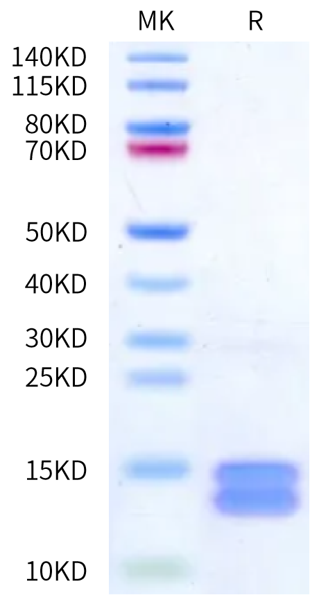 Cynomolgus Calprotectin (S100A8&S100A9) on Bis-Tris PAGE under reduced condition. The purity is greater than 95%.Recombinant Cynomolgus Calprotectin (S100A8&S100A9) Protein