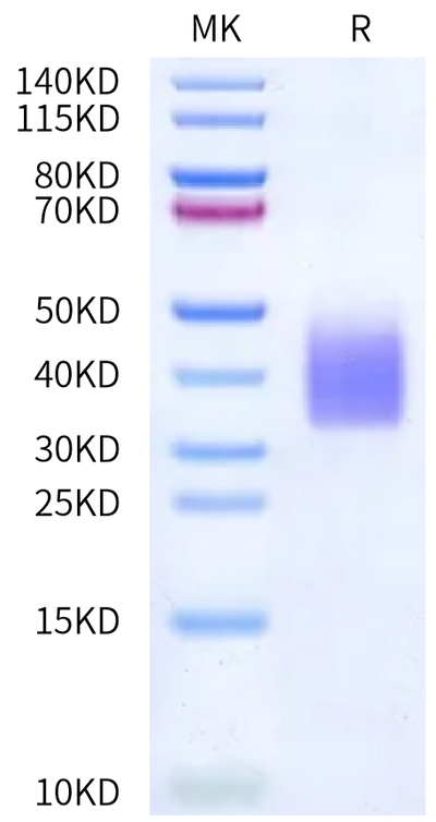 Biotinylated Human GCGR on Bis-Tris PAGE under reduced condition. The purity is greater than 95%.Biotinylated Human GCGR/Glucagon receptor Protein, Active