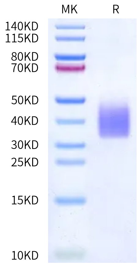 Biotinylated Human GCGR on Bis-Tris PAGE under reduced condition. The purity is greater than 95%.Biotinylated Human GCGR/Glucagon receptor Protein, Active