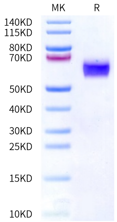 Human IL-1R3 on Bis-Tris PAGE under reduced condition. The purity is greater than 95%.Recombinant Human IL-1R3/IL-1 RAcP Protein, Active