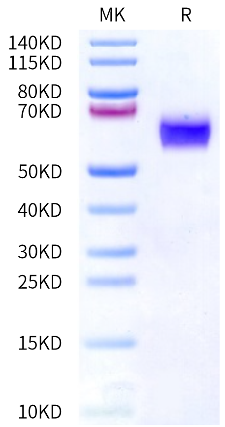 Human IL-1R3 on Bis-Tris PAGE under reduced condition. The purity is greater than 95%.Recombinant Human IL-1R3/IL-1 RAcP Protein, Active