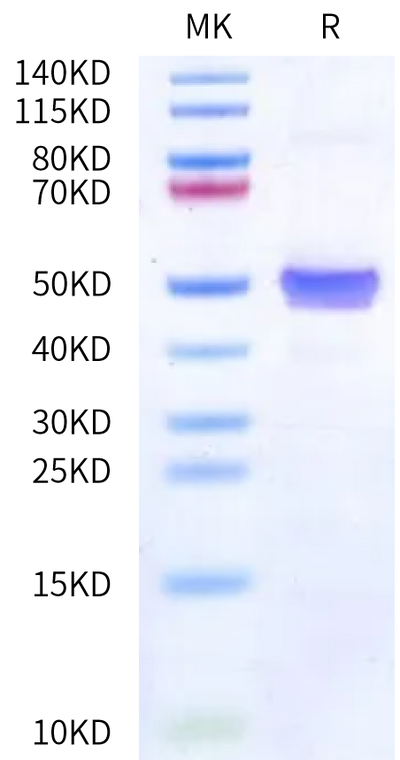 Human pro GDF-8 on Bis-Tris PAGE under reduced condition. The purity is greater than 95%.Recombinant Human pro GDF-8 Protein, Active