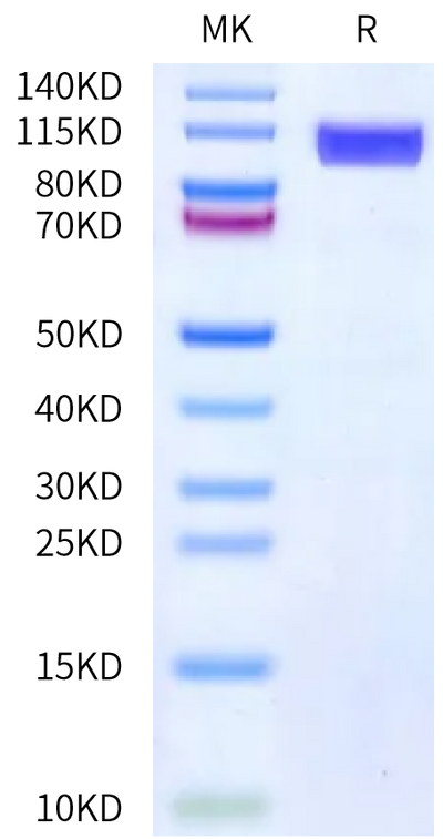 Human CD36 on Bis-Tris PAGE under reduced condition. The purity is greater than 90%.Recombinant Human CD36/SR-B3 Protein