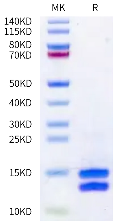 Mouse Calprotectin (S100A8&S100A9) on Bis-Tris PAGE under reduced condition. The purity is greater than 95%.Recombinant Mouse Calprotectin (S100A8&S100A9) Protein