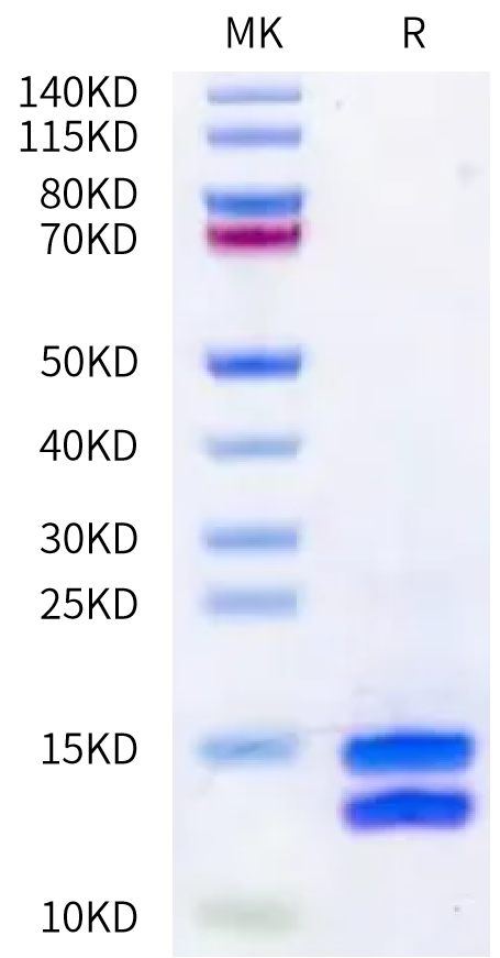 Mouse Calprotectin (S100A8&S100A9) on Bis-Tris PAGE under reduced condition. The purity is greater than 95%.Recombinant Mouse Calprotectin (S100A8&S100A9) Protein