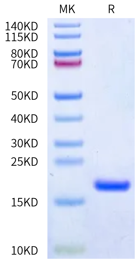 Human IL-36 alpha on Bis-Tris PAGE under reduced condition. The purity is greater than 95%.Recombinant Human IL-36 alpha/IL-1F6 Protein
