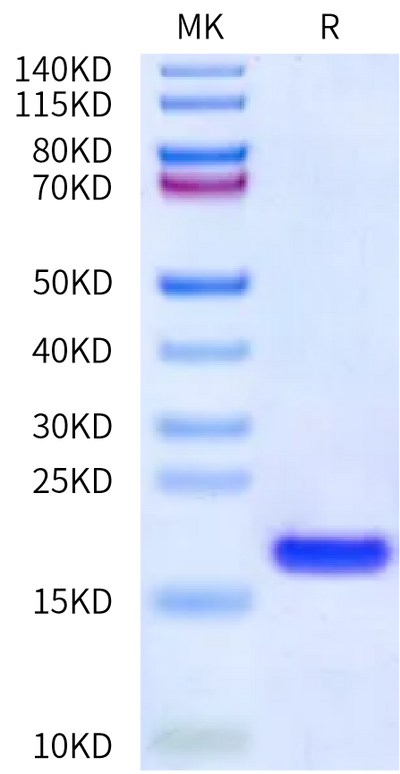 Human IL-36 Beta on Bis-Tris PAGE under reduced condition. The purity is greater than 95%.Recombinant Human IL-36 Beta/IL-1F8 Protein
