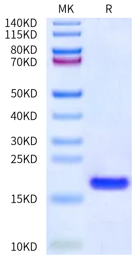 Human IL-36 Beta on Bis-Tris PAGE under reduced condition. The purity is greater than 95%.Recombinant Human IL-36 Beta/IL-1F8 Protein